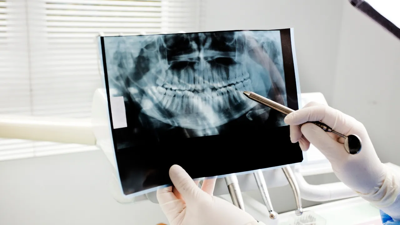 Oral Cancer Treatment