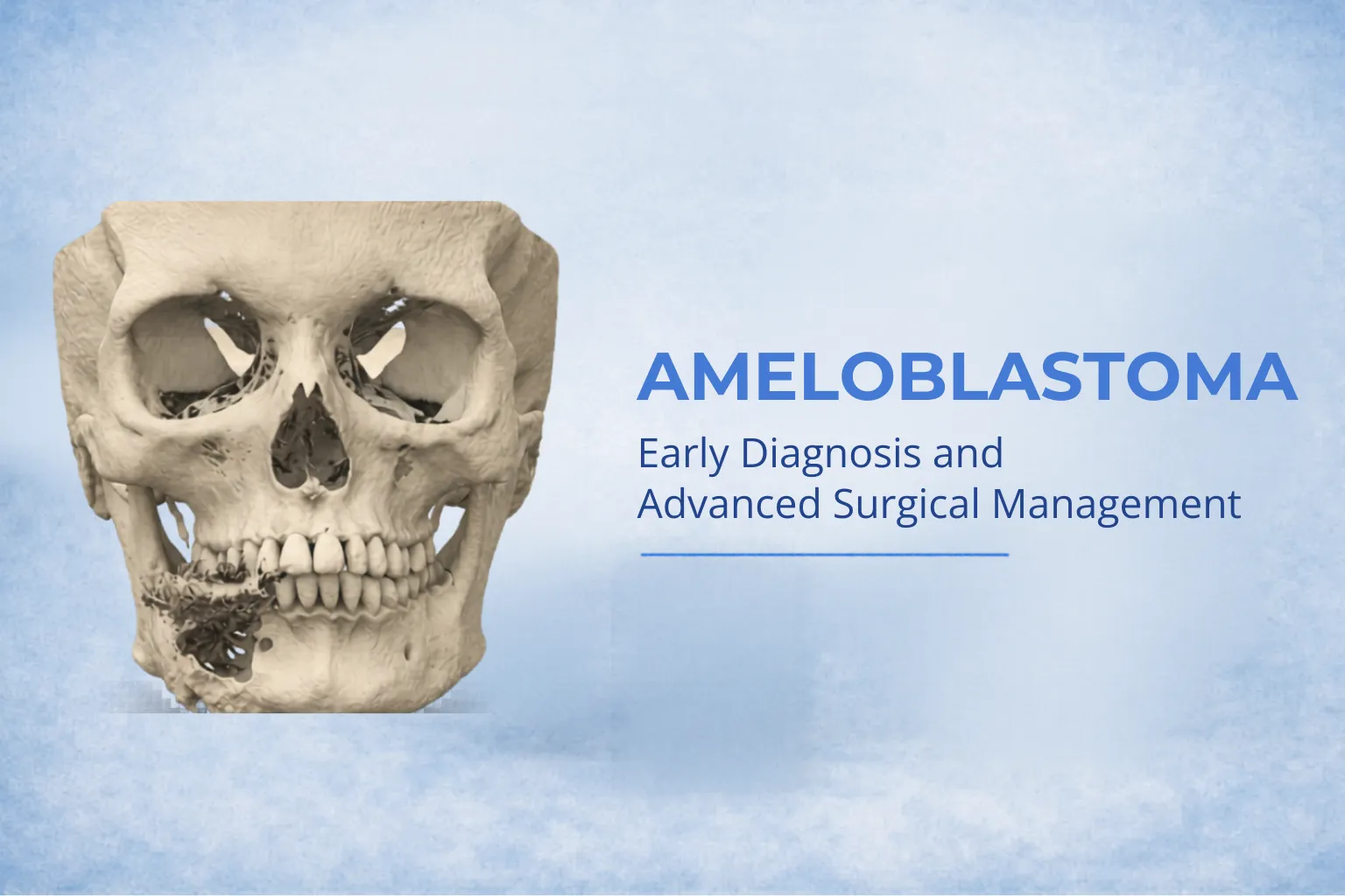 Ameloblastoma Treatment